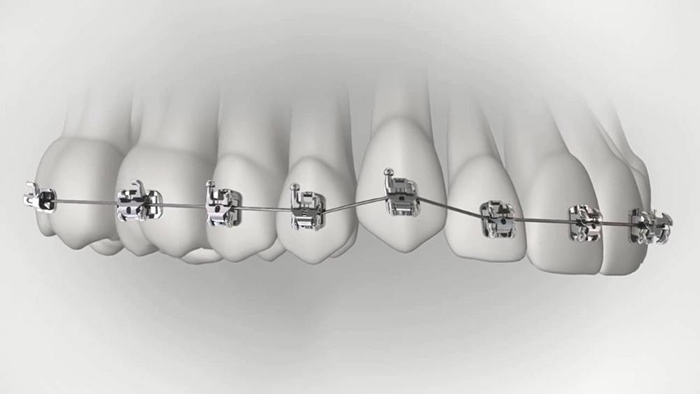 承德市哪家口腔醫(yī)院口腔正畸做得好？惟德口腔醫(yī)院來告訴您