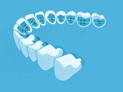 惟德口腔醫(yī)院口腔正畸好不好？